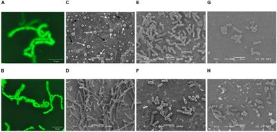 Isolation, Development, and Genomic Analysis of Bacillus megaterium SR7 for Growth and Metabolite Production Under Supercritical Carbon Dioxide